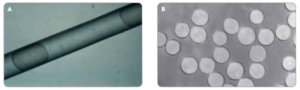 microbilles dans l'embolisation de la prostate